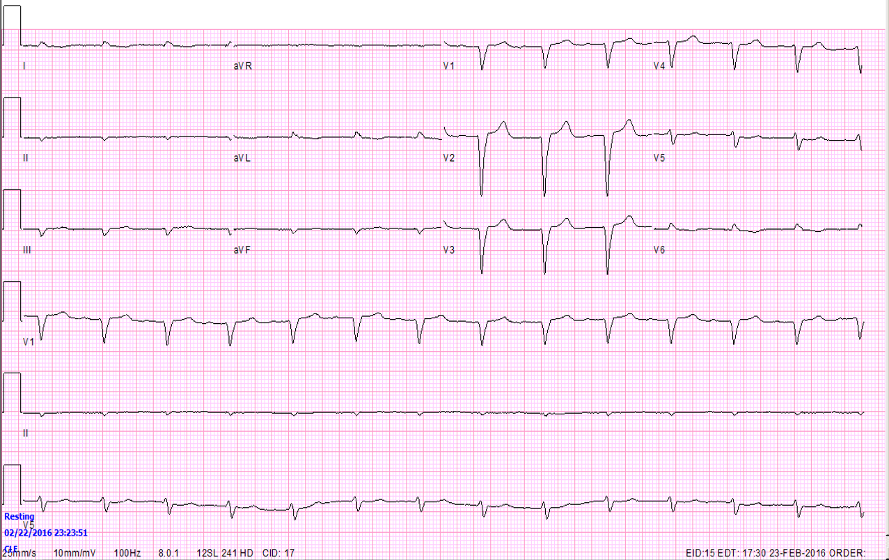 Shortness of breath in a 68 y/o man | Test Interpretation | Case Study ...