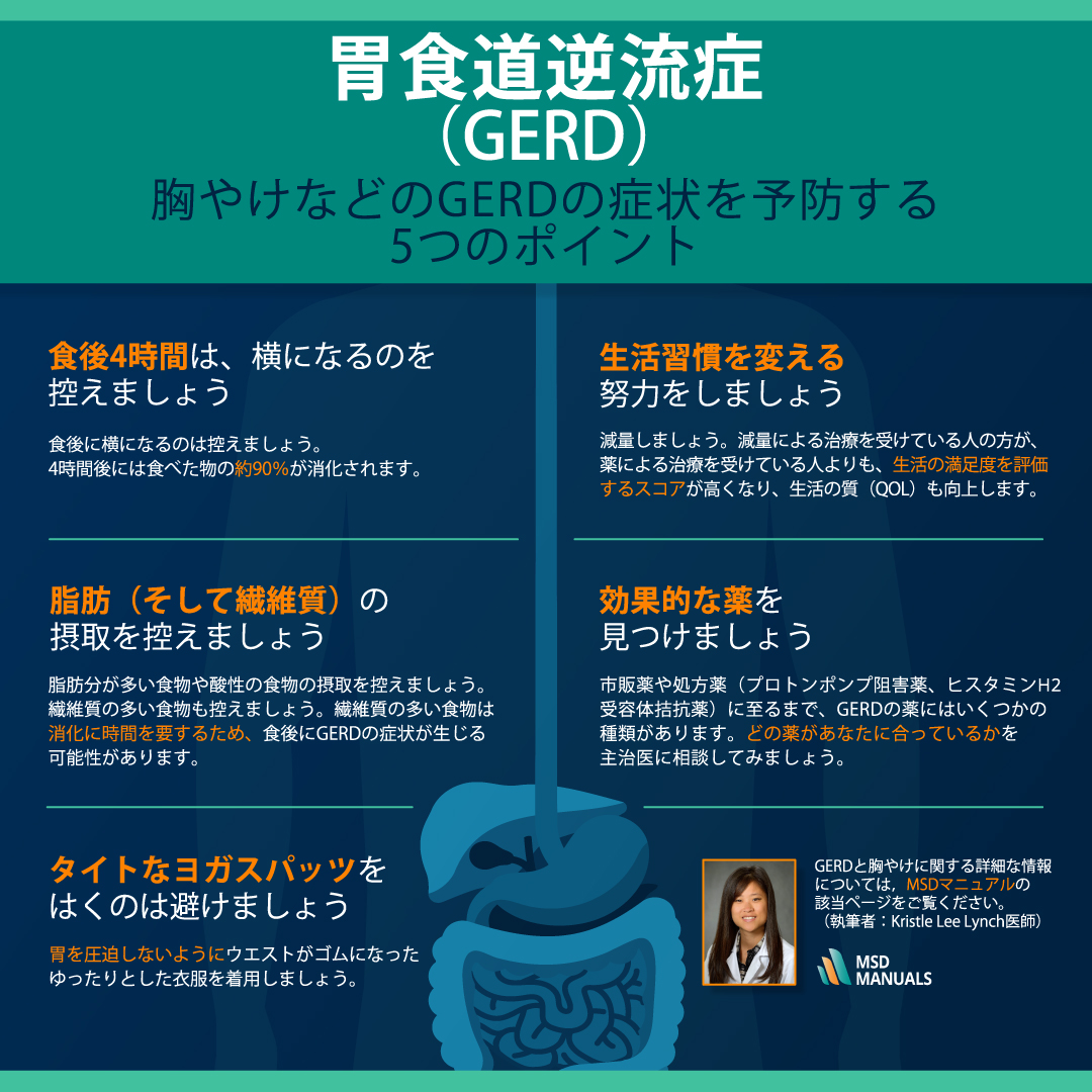 胃食道逆流症（GERD）とは？ 胸やけの予防と軽減のための5つのポイント