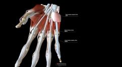 Flexor Tendon Sheaths of the Fingers