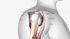 rotary cuff syndrome