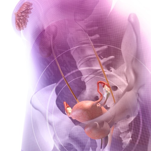 Comment appliquer une attelle longue de bras - Blessures; empoisonnement -  Édition professionnelle du Manuel MSD