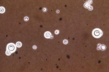 Nhuộm mực Ấn Độ (Cryptococcus neoformans)